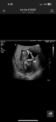 November 2023 babies - thread 4
