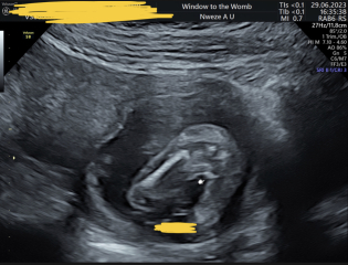 Any ideas on the gender ? 