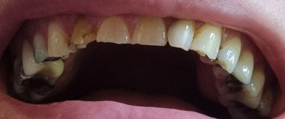 £12k for dental treatment?! 