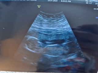 Due January Part 5 🎉