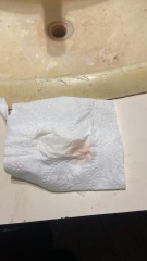 Implantation bleeding?!