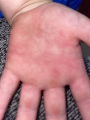 Can anyone tell me what this is on my son please?