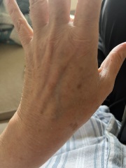 Can anyone tell me what these are on my hand?