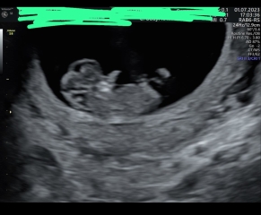Boy or girl 