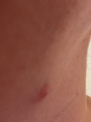 Lump under jaw