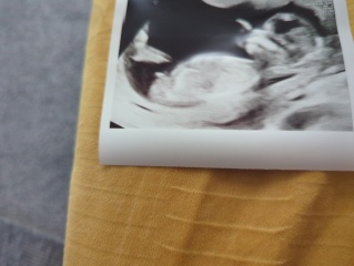 Boy or Girl