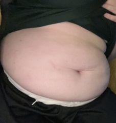 diastasis recti yes or no?
