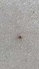 What could this black spot on my leg be?