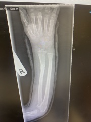 Does this arm look to be healing ok?