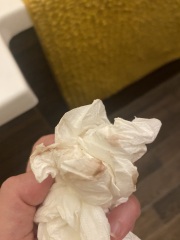 Another implantation bleed or period?! TW PHOTOS ATTACHED
