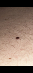 Does this look concerning? 