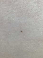 What could this black spot on my leg be?