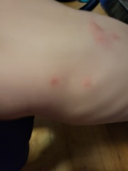 What are these spots?