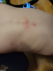 What are these spots?