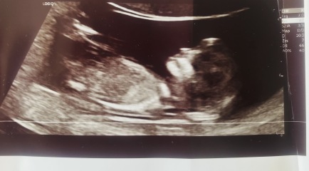 Pls would you guess our gender!!! Too excited to contain myself!!