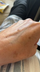 Can anyone tell me what these are on my hand?