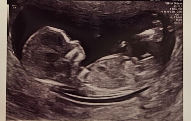 Scan gender theory 
