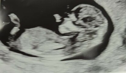 Boy or girl?