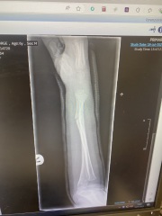 Does this arm look to be healing ok?