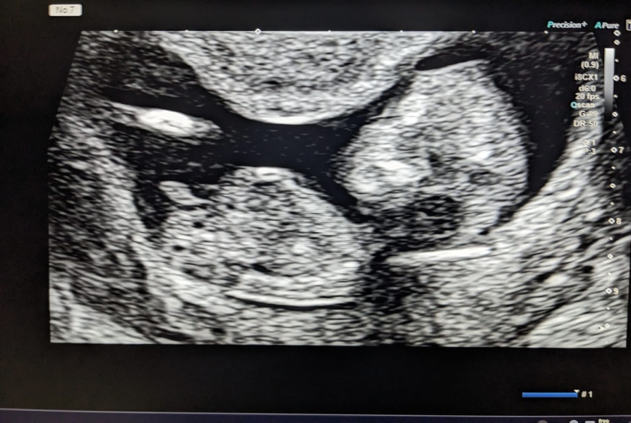March 2024 continued!