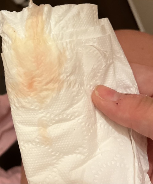 Could this be implantation bleeding?