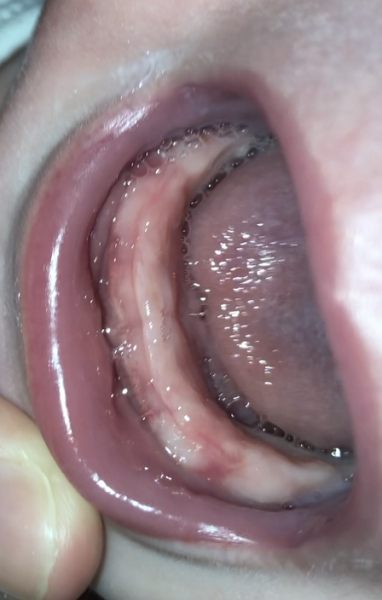 Are these teething gums?
