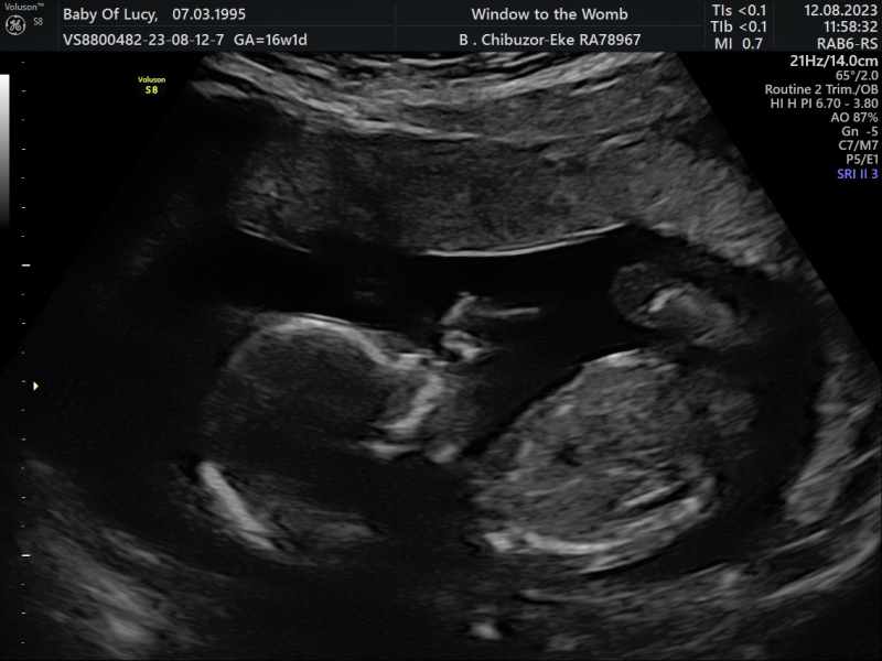 Due January Part 5 🎉