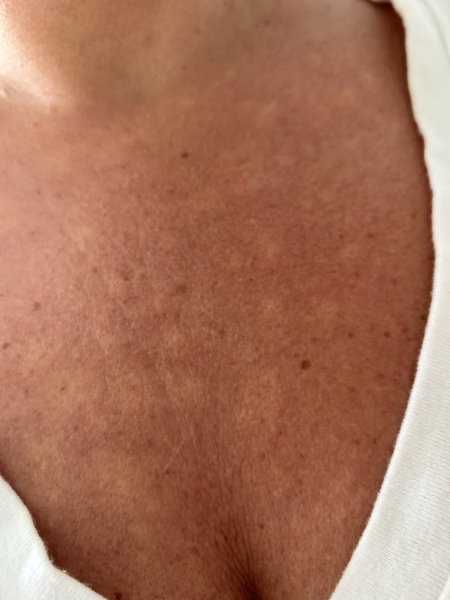Why is my skin always like this? - pics