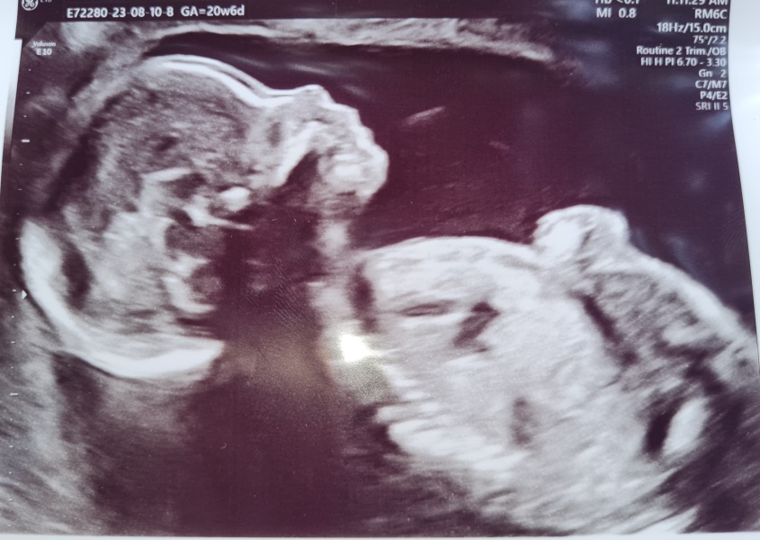 I think I'm close to 5th miscarriage in a row.  No children yet. Feeling so sad...