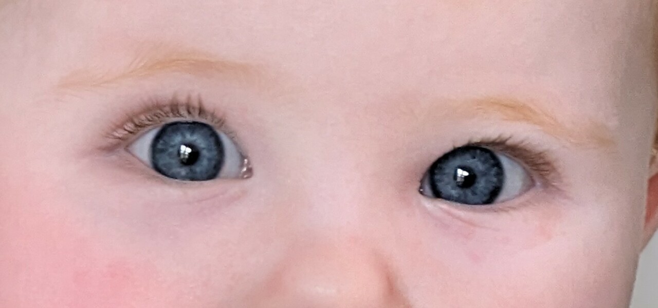 8 month possible squint?