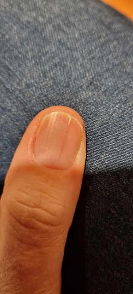 My thumbnail keeps splitting