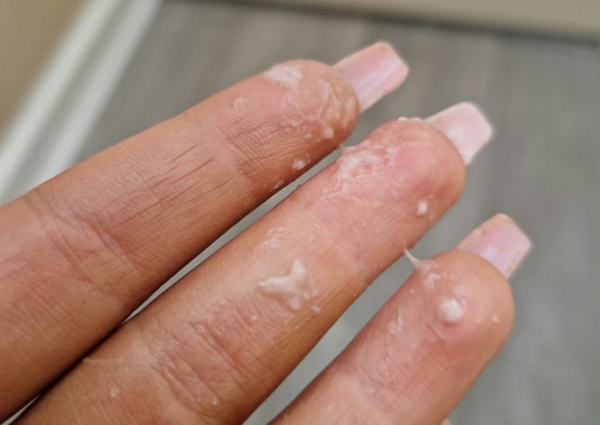 Snotty discharge before bfp?