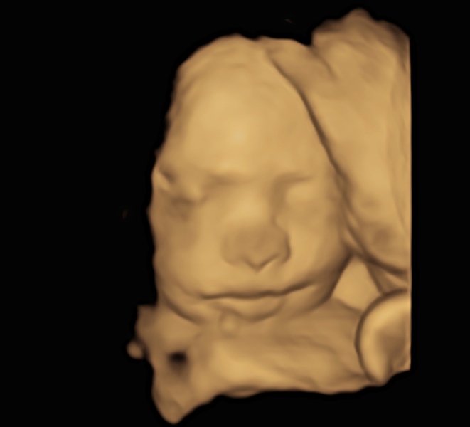 Due October 2023 Thread 8
