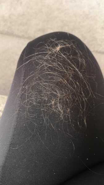 Ozempic for those a few months in - part 3