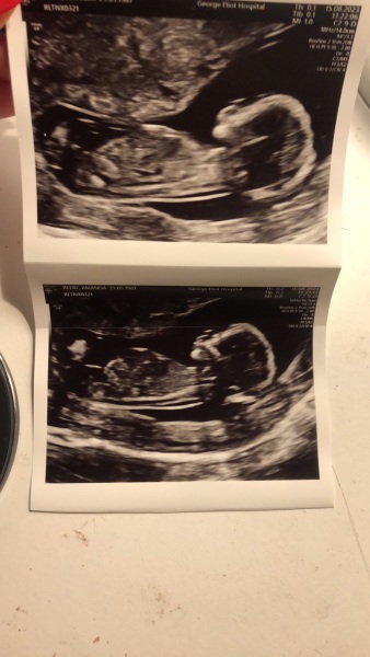 Boy or girl