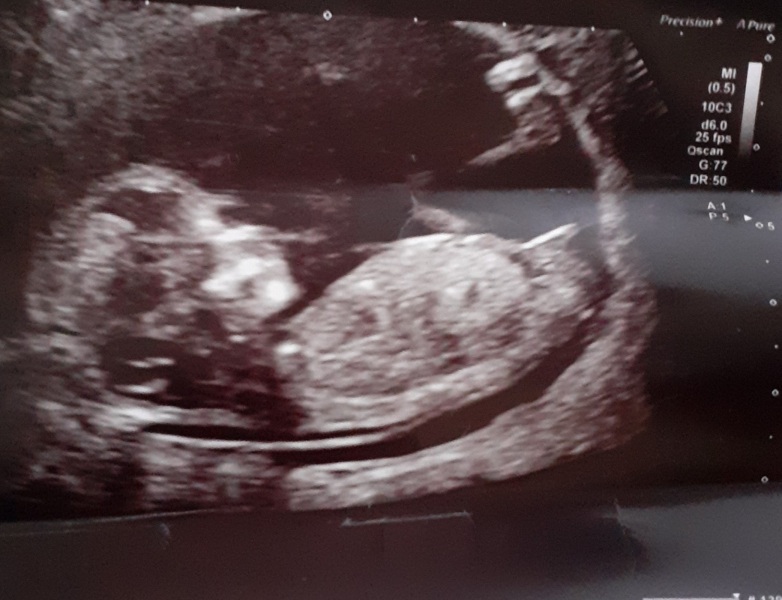Nub theory gender guesses?