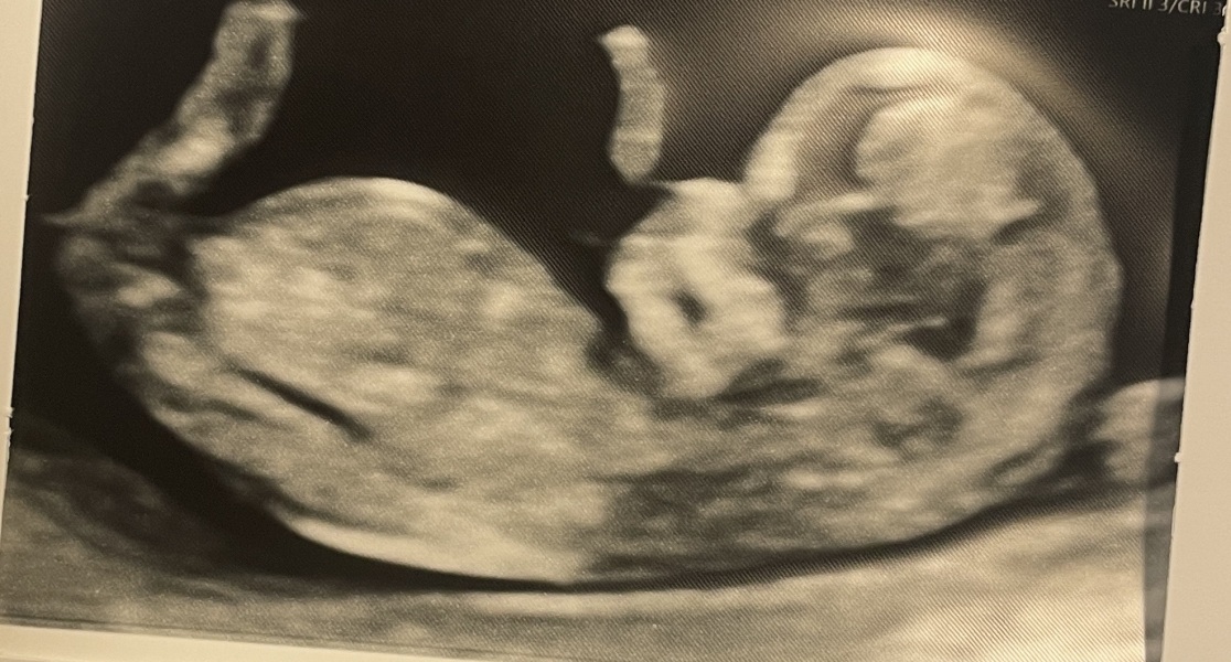 Girl or boy? Nub theory?!