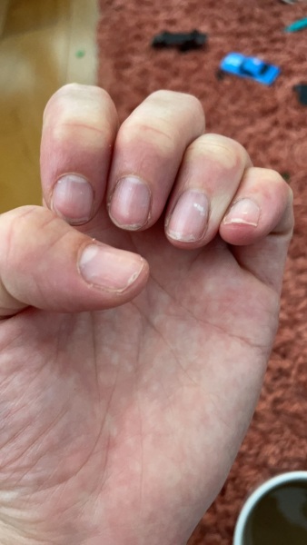 My nails are awful, is there anything that can help?