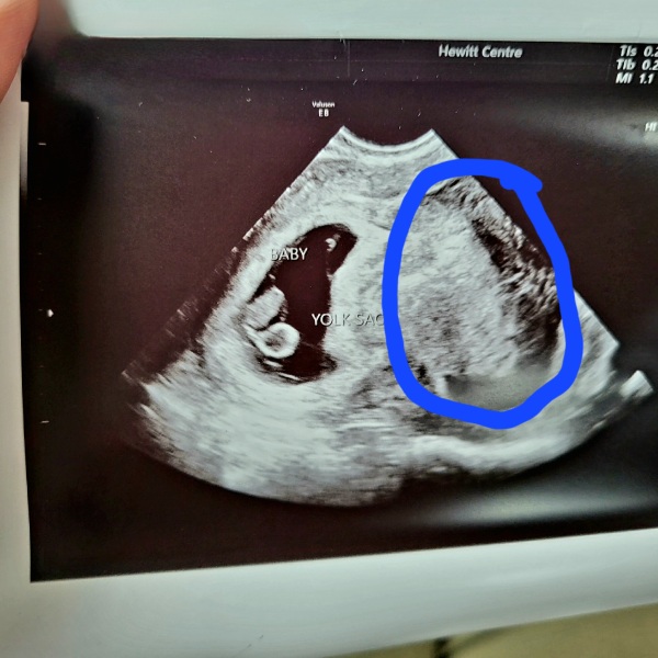 IVF April 2023