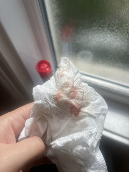 Is this normal? 5 weeks 1 day