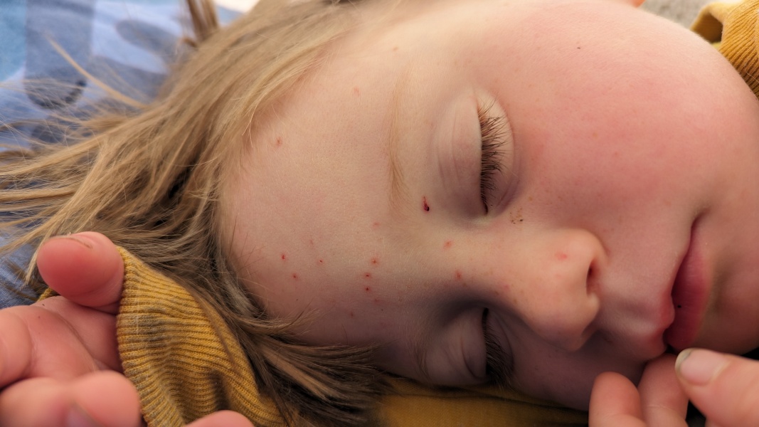 Little spots