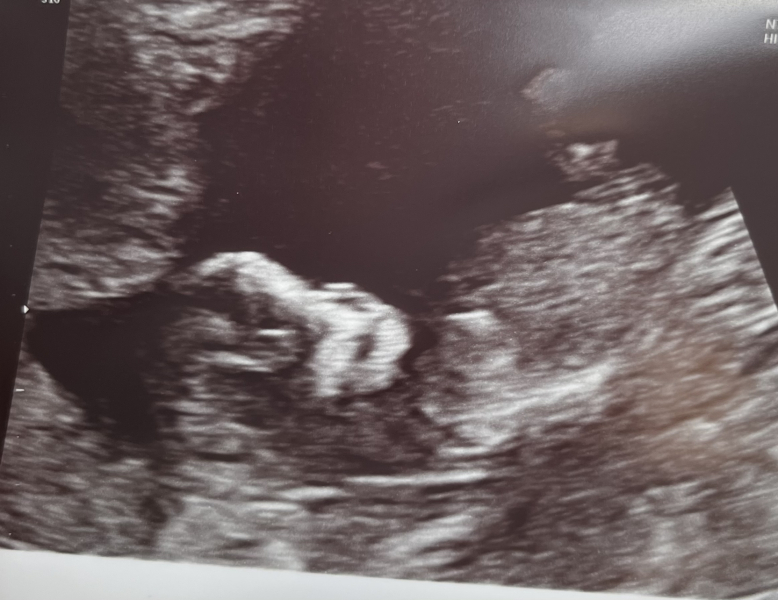 Boy or girl predictions please!