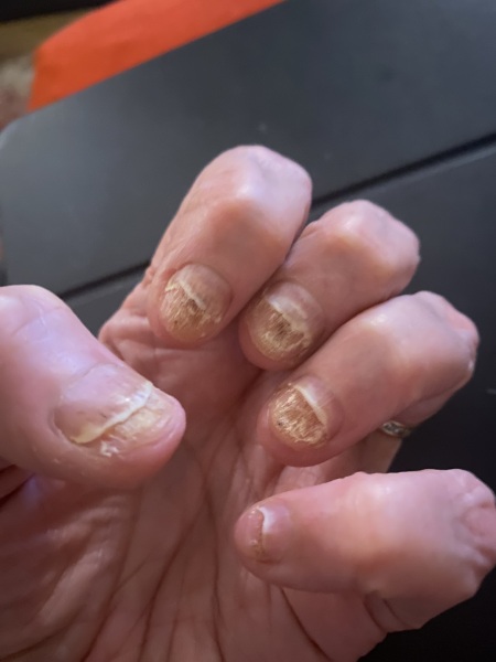 Would you allow your 12 year old to have acrylic nails?