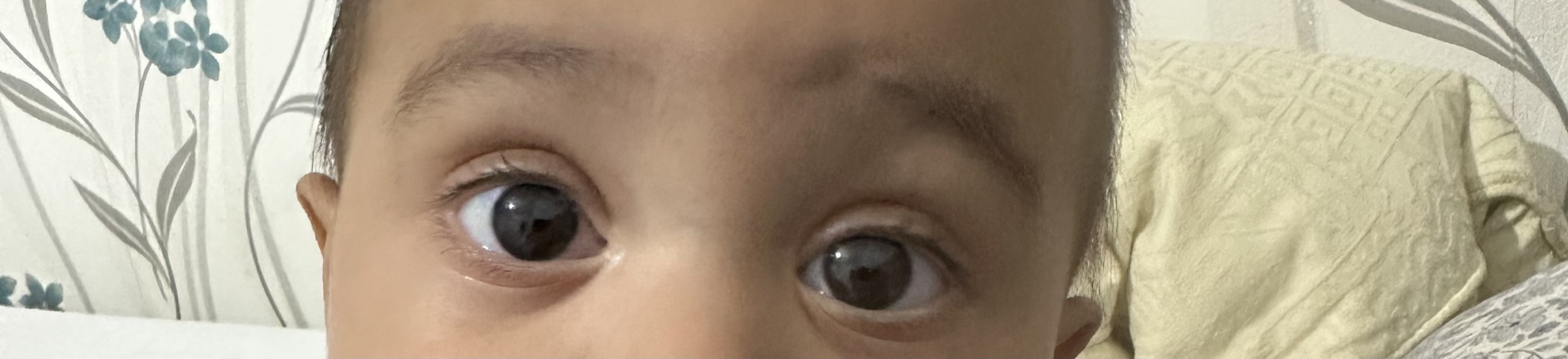 9 month old has itchy eyes