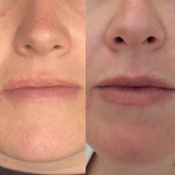 Lip blush - i rather fancy it.
