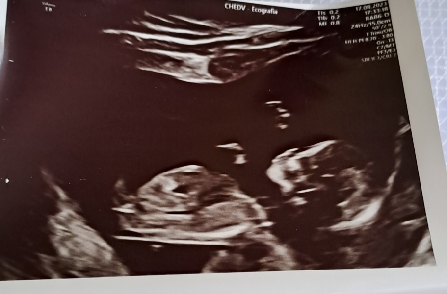 February 2024 Babies 👶 (thread 3)