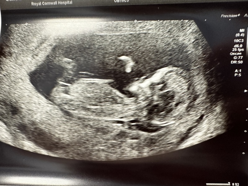 February 2024 Babies 👶 (thread 3)