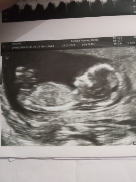 Please guess the gender by the scan