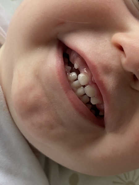 Any dentist opinion?