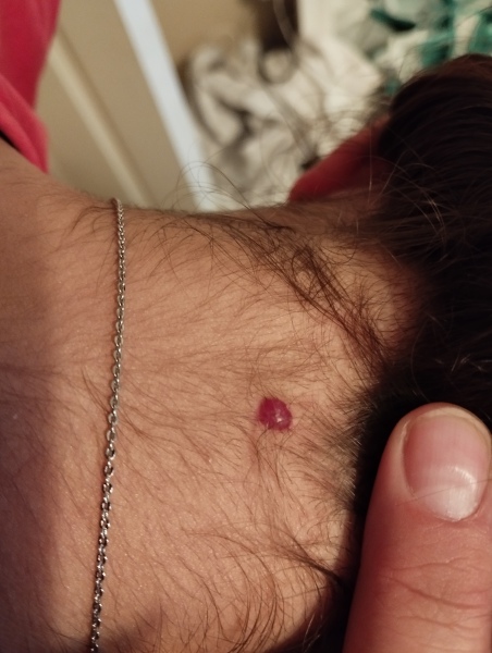 Should I get this spot checked?